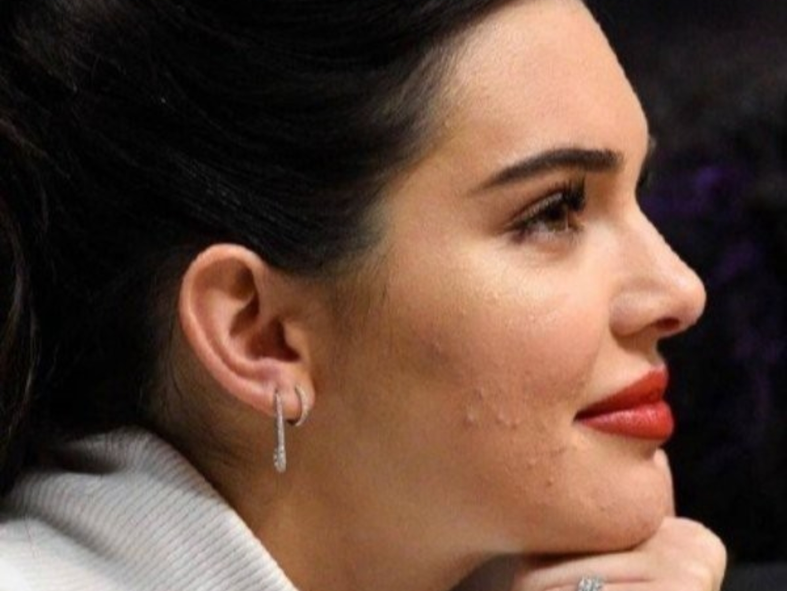 【明星也會醜】26 歲也會爆痘！Kendall Jenner「零 P 照」曝光：３ 招保養技巧教你改善爛臉！