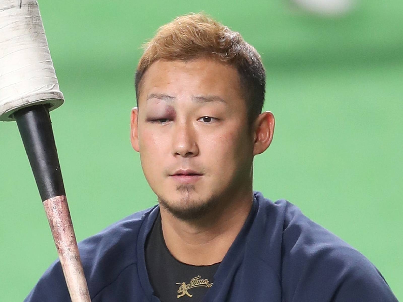 中田翔暴打隊友到腦震盪，日本職棒火腿隊宣布「無限期禁賽」！