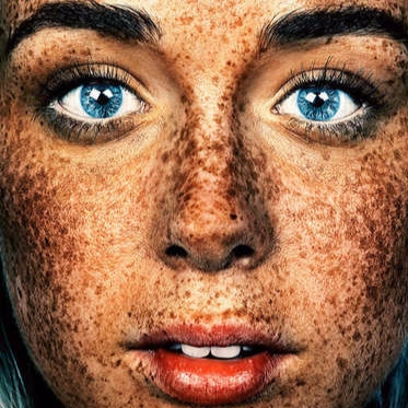 專拍雀斑的倫敦攝影師　讓雀斑 #Freckles 成為網路焦點！