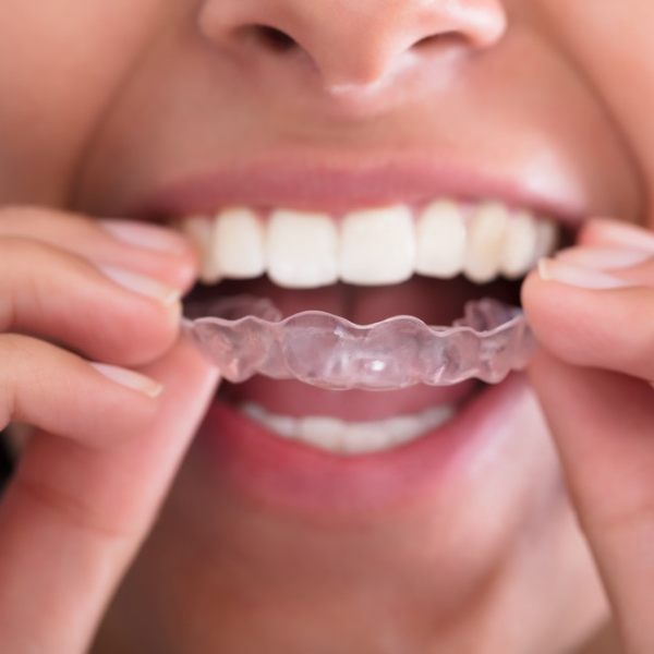 原來喝運動飲料對牙齒有害！牙醫師告訴你 7 個危害牙齒的壞習慣　咬冰塊絕對是大忌！