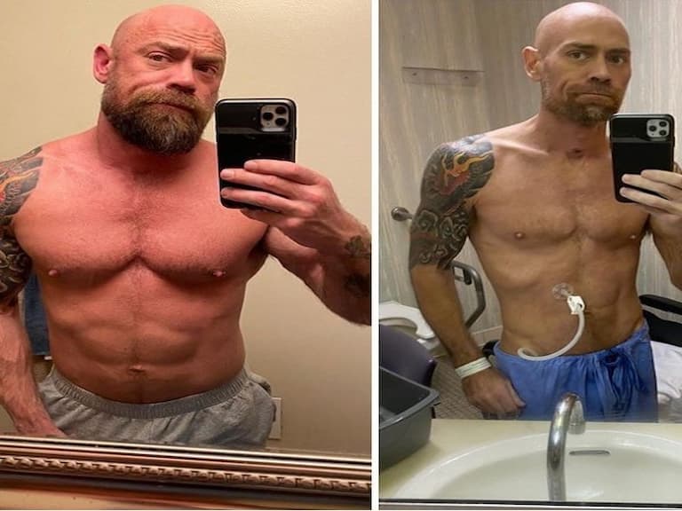 染上新冠肺炎一個月的差別!美國肌肉男「暴瘦蒼老」判若兩人,懺悔:我原以為自己夠年輕...