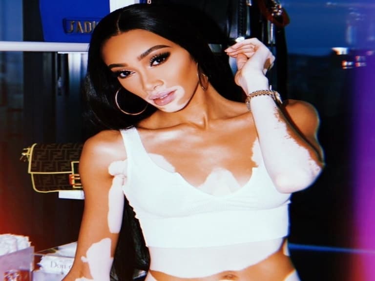 Winnie Harlow、Adut Akech Bior ...  5 位事業開外掛的「黑人模特兒」，私服穿搭也超有料！