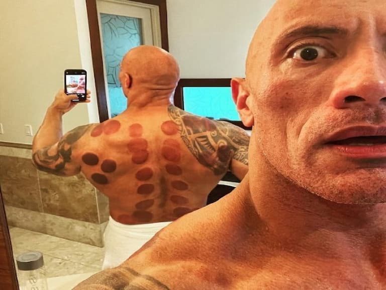 巨石強森第一次體驗「拔罐」,好萊塢最強肌肉猛男被一大片黑青嚇到!