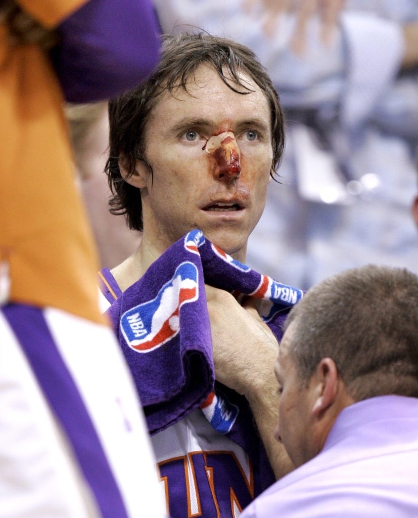 2007 年 Steve Nash 鼻樑被撞到流血