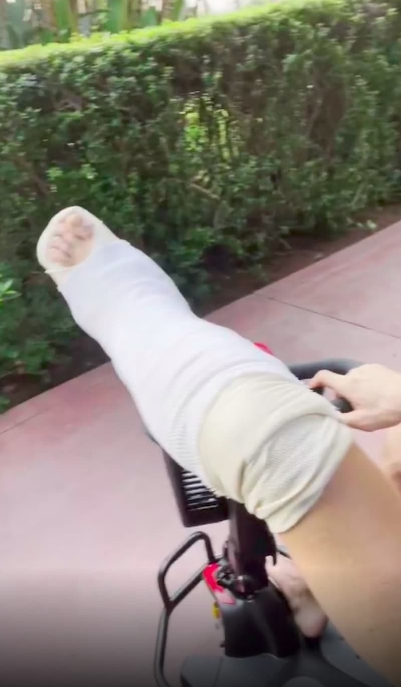 Conor McGregor 出院後，左腳全部綁上繃帶