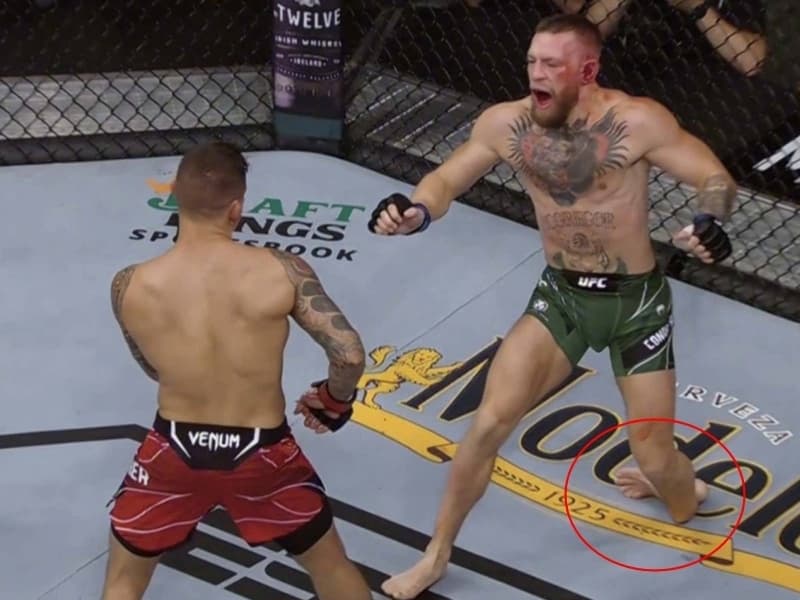 Conor McGregor 在先前比賽中，遭遇斷腿事件