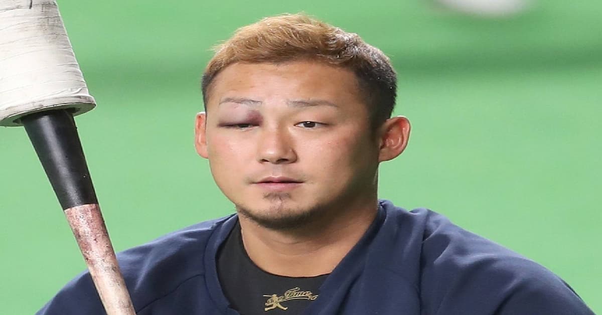 中田翔暴打隊友到腦震盪,日本職棒火腿隊宣布「無限期禁賽」! JUKSY 街星
