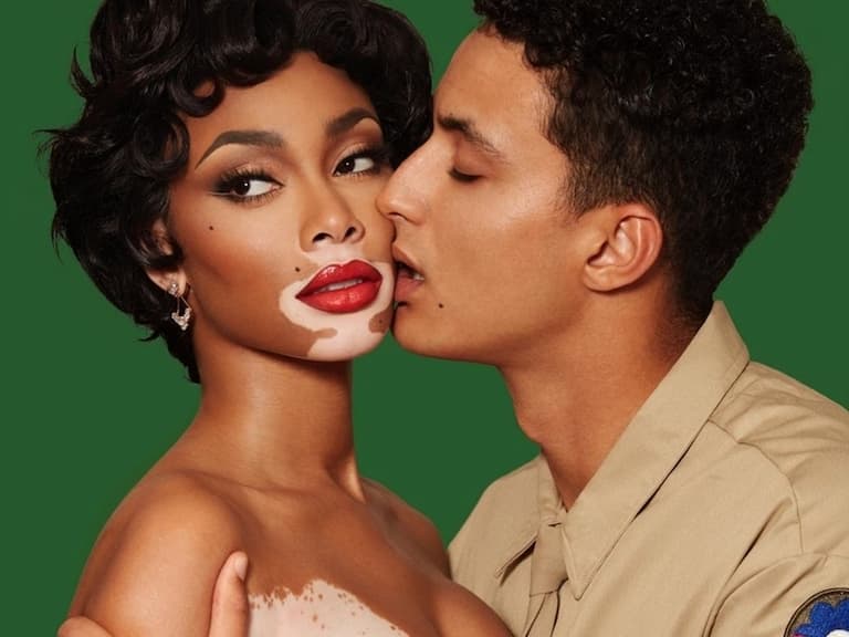 NBA／Kyle Kuzma 與白斑症名模 Winnie Harlow 分手！離開 LA 真的差這麼多！？