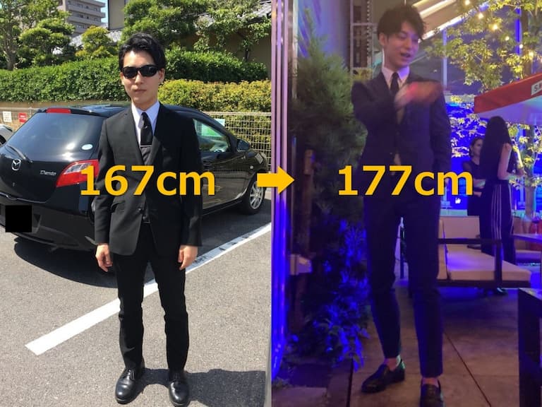 日本型男豪砸百萬做「骨骼延長手術」，167 公分圓夢抽高 10 公分成真正「高富帥」!