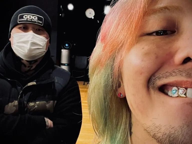 【J 個有意思】GD 的「愛心寶石牙齒」超吸睛，盤點 4 個關於「Grillz」必知事情！