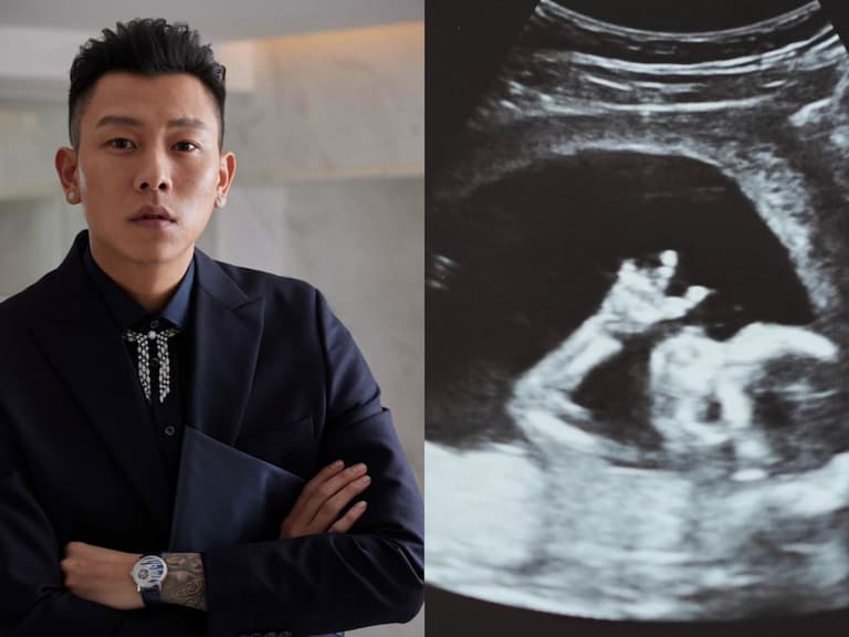 頑童瘦子升格當爸了！IG 搶曬嬰兒超音波照甜喊：「Say what’s up to the world, kid！」