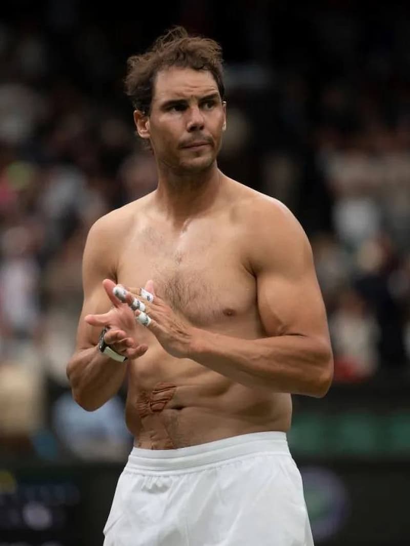 Nadal 腹部傷勢在稍早比賽中擴大，確定無法續戰溫網