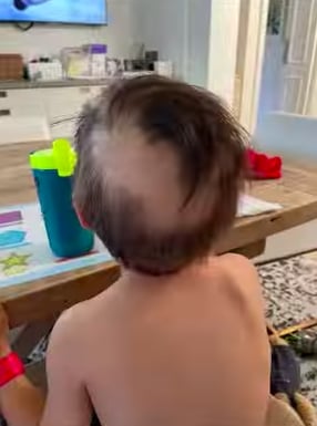 Erik Spoelstra 兒子因化療而掉頭髮