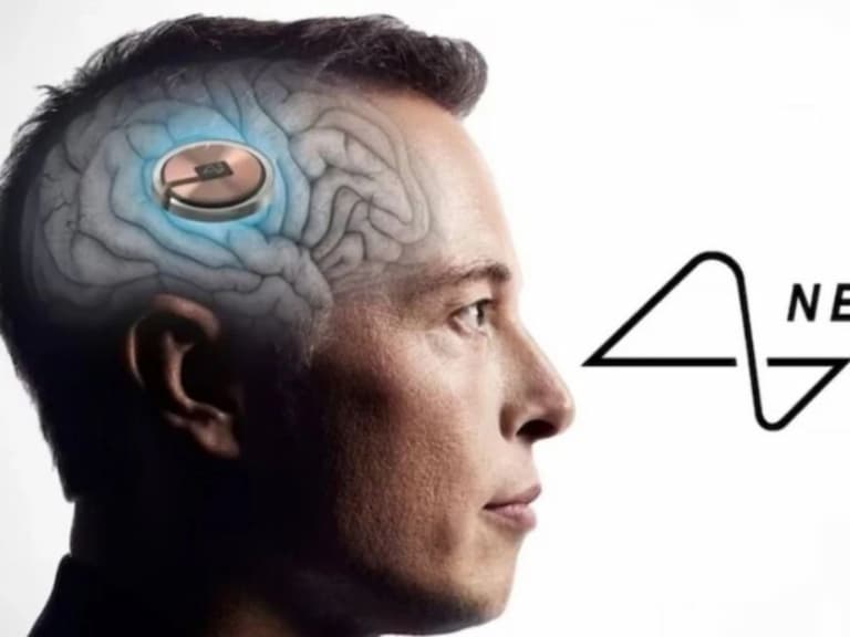 馬斯克大腦晶片公司 Neuralink 招募「植入手術試驗者」，超過千人瘋搶報名！