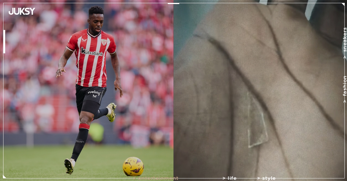 足球球星伊納基威廉斯（Iñaki Williams）腳掌內藏有玻璃碎片