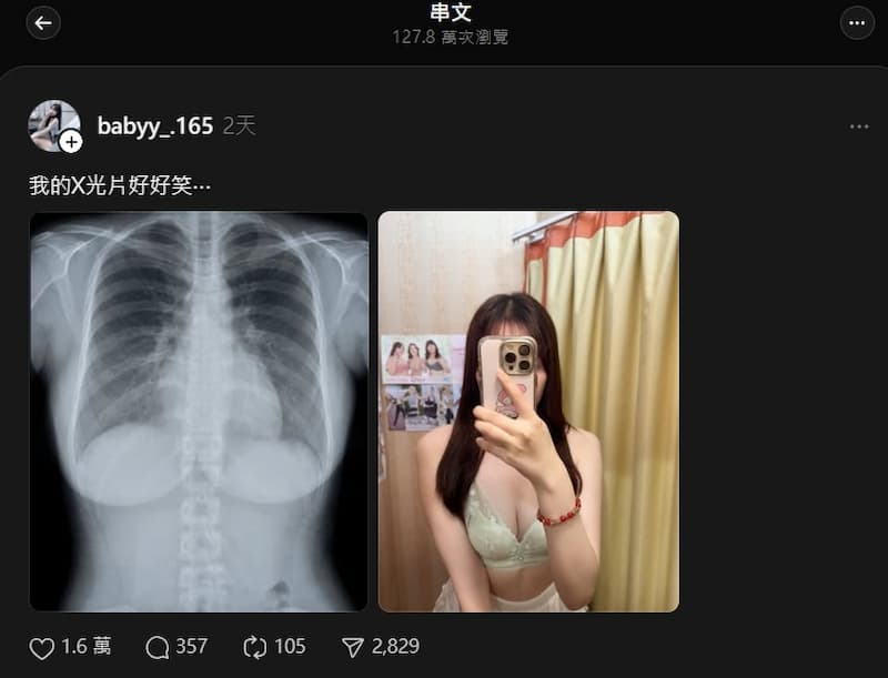 兔兔