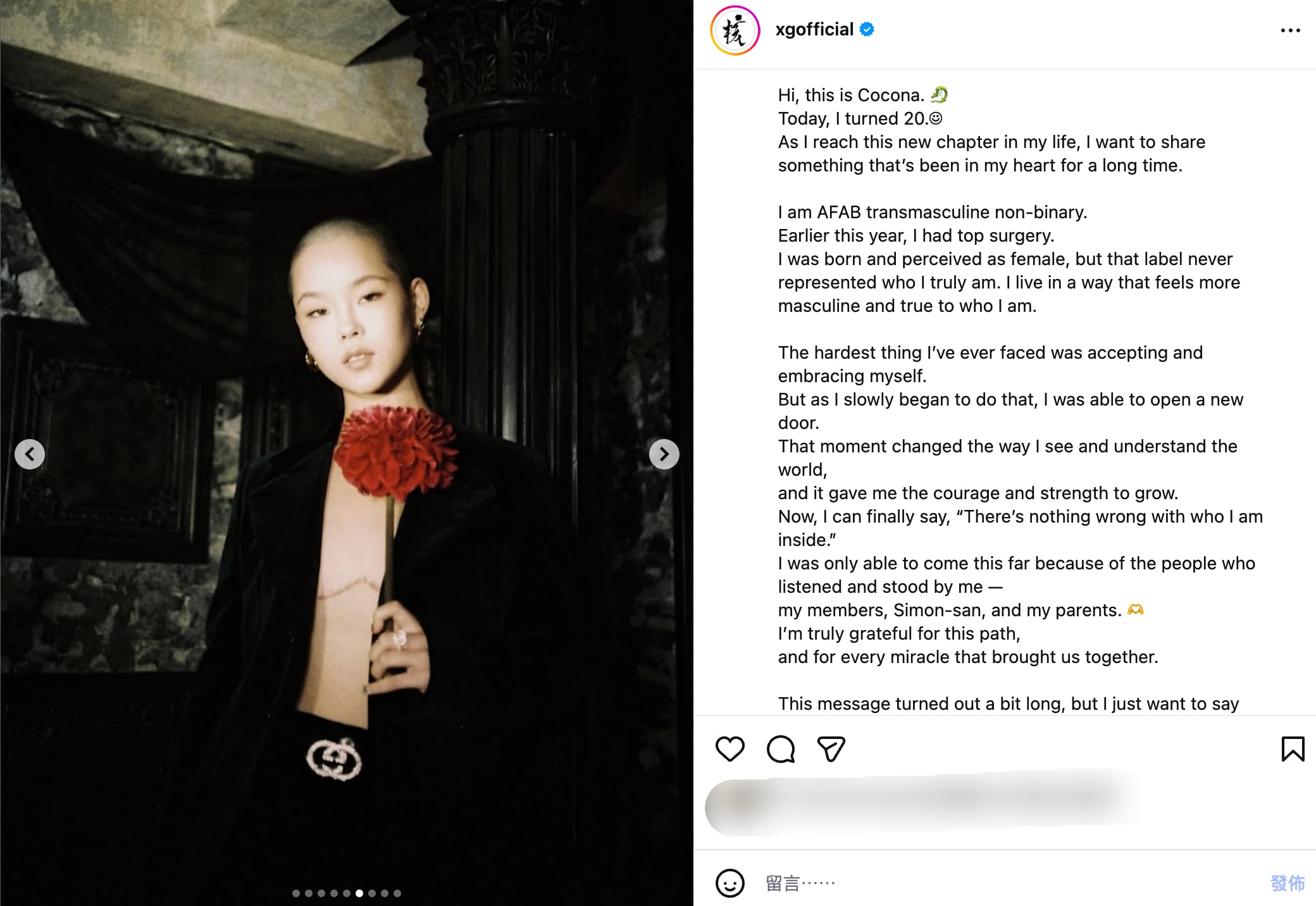 XG 成員 Cocona 曝切除胸部疤痕照!生日吐心聲:「內心的自己沒有錯!」