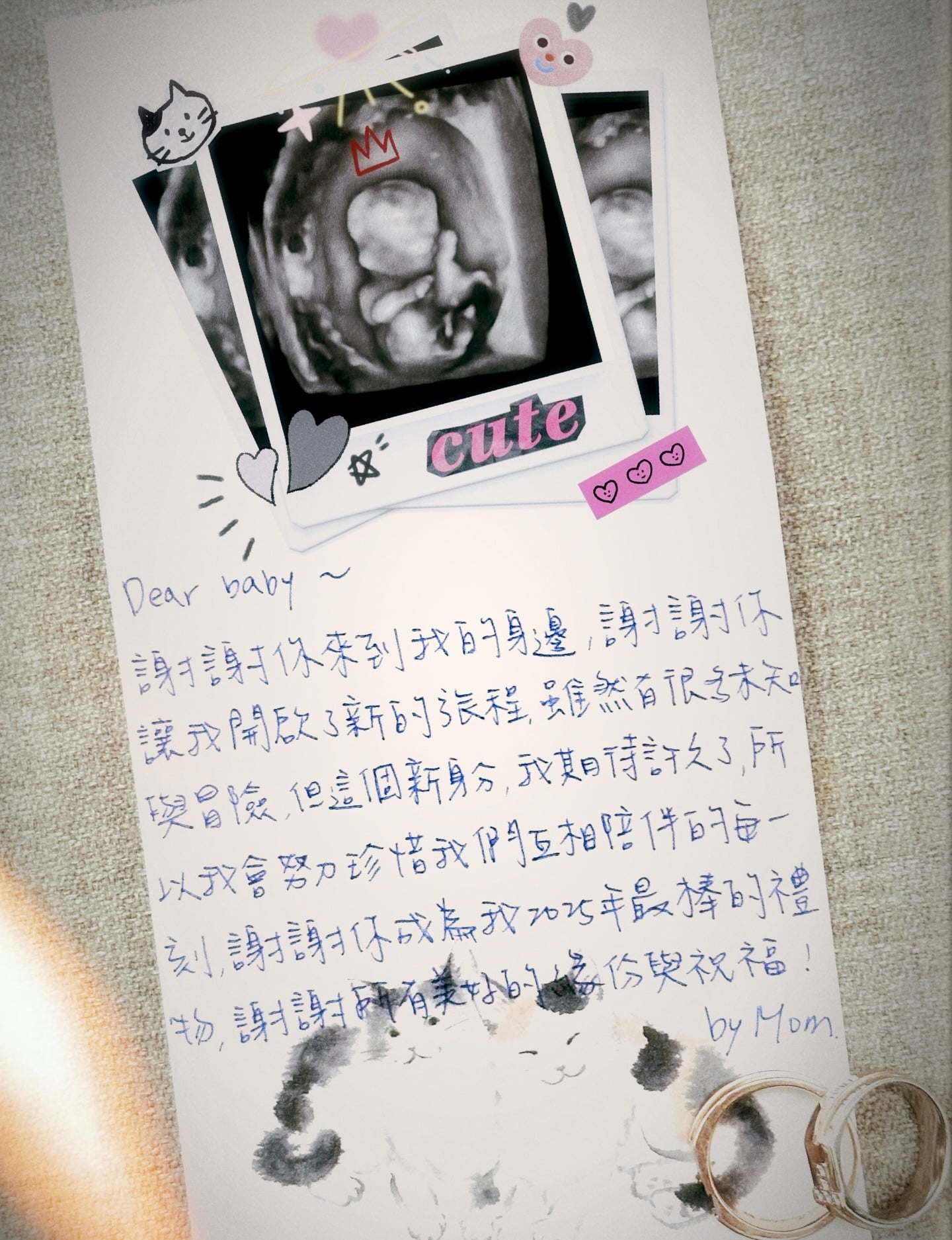 夏于喬懷孕了!41 歲結婚 6 年終迎馬寶寶 曬超音波照感動喊話