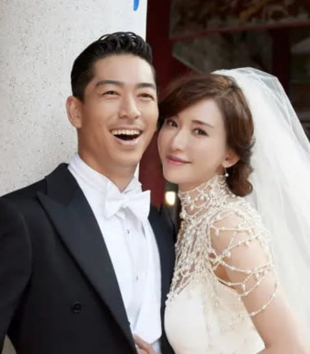 林志玲遭質疑面相變了!本人高 EQ 回應:「沒有人是 100 分」化解爭議!