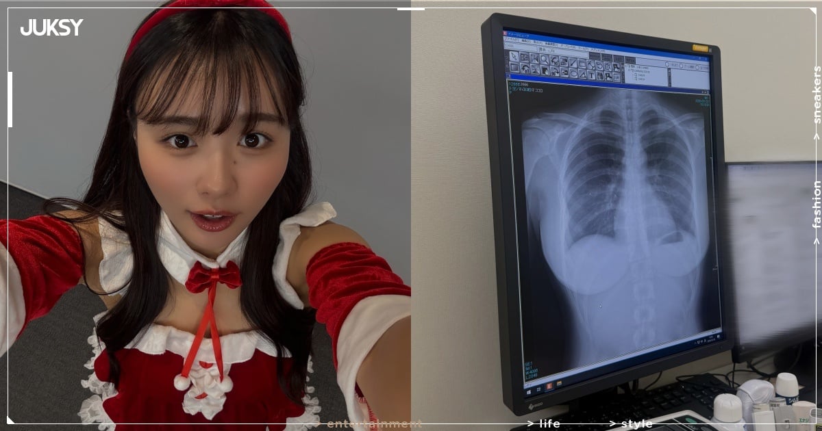 日本寫真女星豐島心櫻曬肺部 X 光片,天然完美胸型意外引網歪樓!