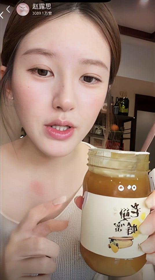 趙露思直播硬吃蜂蜜當場過敏！零抽佣銷售額曝光引粉絲心疼！