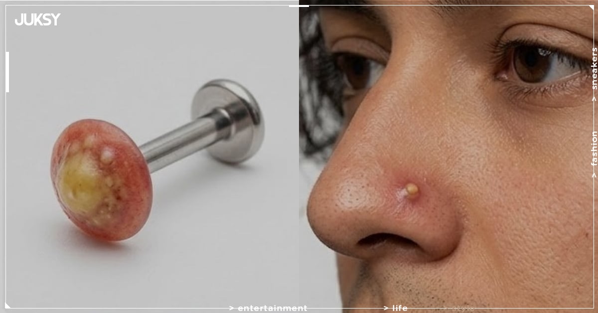 夏季長痘痘怎麼辦？預防＋修護＋防曬完整攻略，2026 保養推薦一次看！