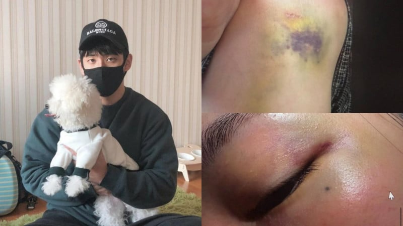 BLACKPINK Jisoo 親哥金政勳家暴醜聞！大嫂曝光3頁血淚控訴、全身傷照震驚韓網