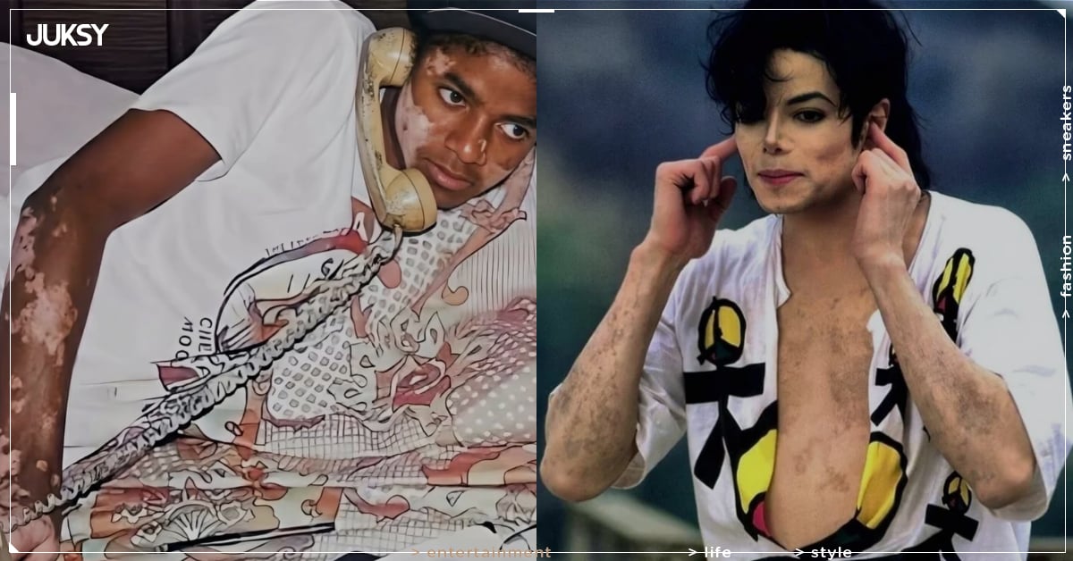 麥可傑克森 Michael Jackson 皮膚變白真相曝光！傳記電影揭病因，粉絲淚喊：「外界欠他一個道歉！」