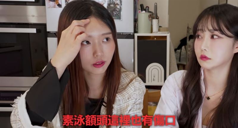 鄭嘉睿親揭與素泳遭霸凌內幕！頭流血被逼上場坦言：「將定居台灣療癒休息！」