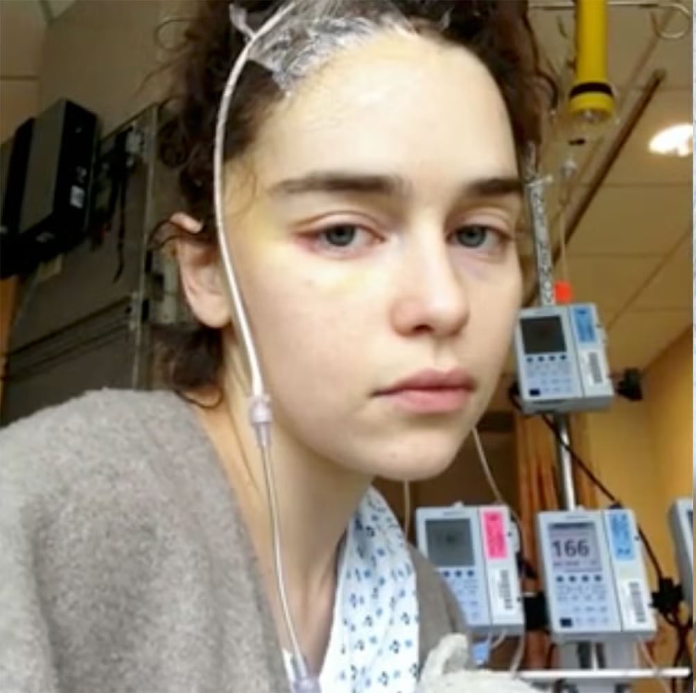 艾蜜莉亞克拉克 Emilia Clarke 罕見談曾腦動脈瘤破裂!坦言:「我本該 S 去!」