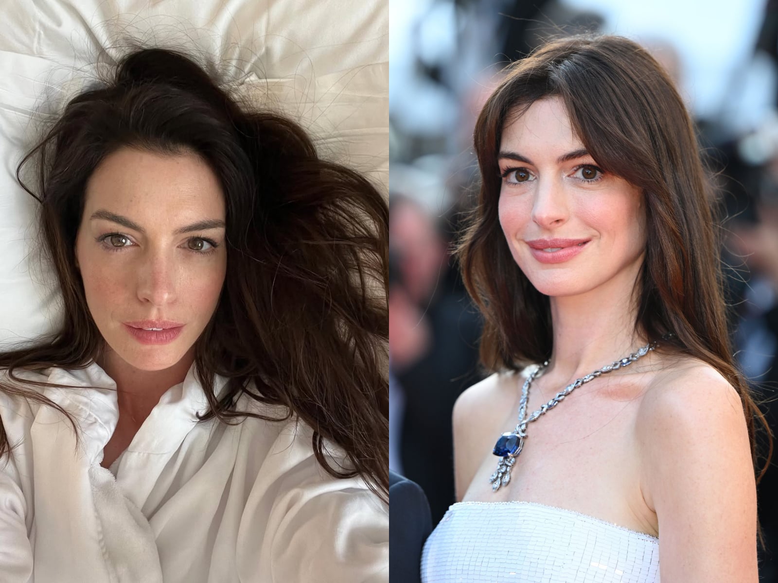 安海瑟薇 Anne Hathaway 整形了嗎？罕見回應並坦承：「未來有考慮！」