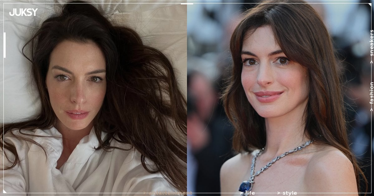 安海瑟薇 Anne Hathaway 整形了嗎?罕見回應並坦承:「未來有考慮!」