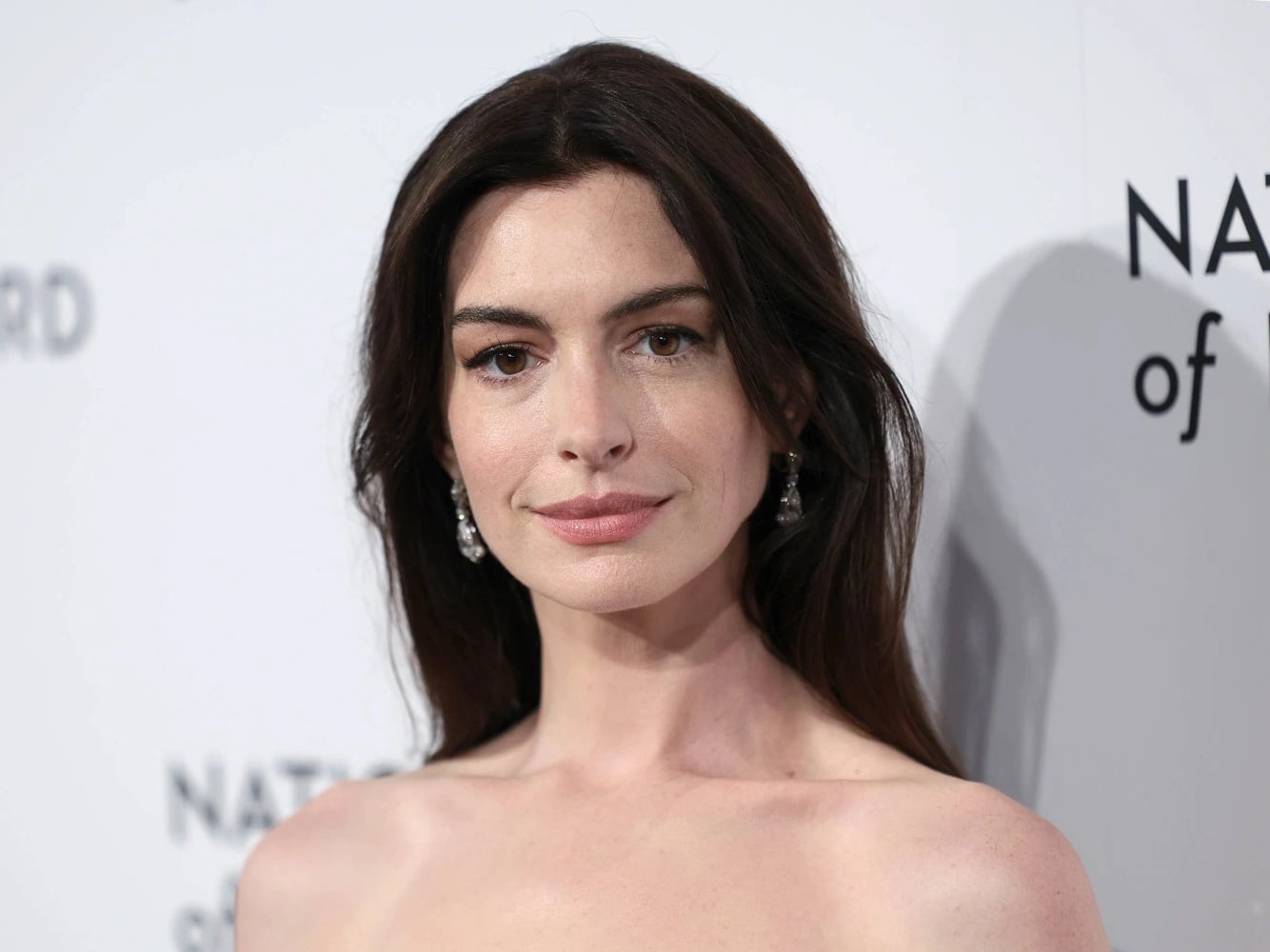 安海瑟薇 Anne Hathaway 自爆眼睛失明！坦言：「幾乎半盲狀態！」