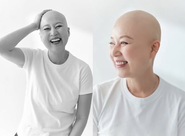 《順風婦產科》朴美善罹癌後近況曝光！首度公開化療血淚史：「痛到想死」