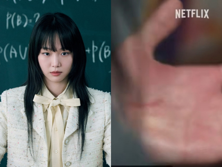 《鐵拳教育》拍攝出意外！朴敘允透露秦基周手部流血受傷，真相曝光讓全場傻眼！