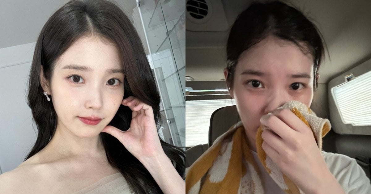 IU