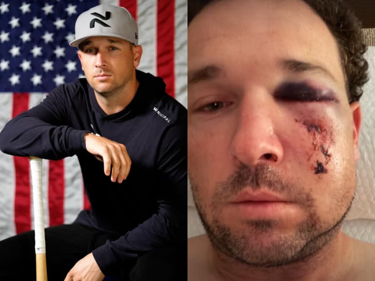 小熊布萊格曼 Alex Bregman 遭界外球砸臉！多處骨折免手術 拚季後賽回歸