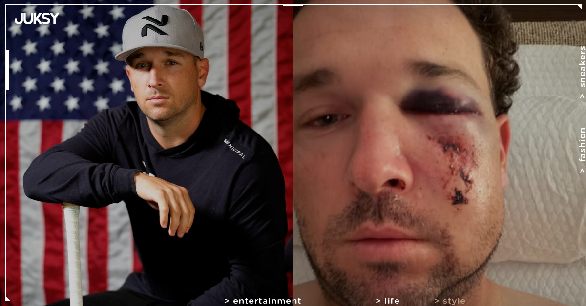 小熊布萊格曼 Alex Bregman 遭界外球砸臉!多處骨折免手術 拚季後賽回歸