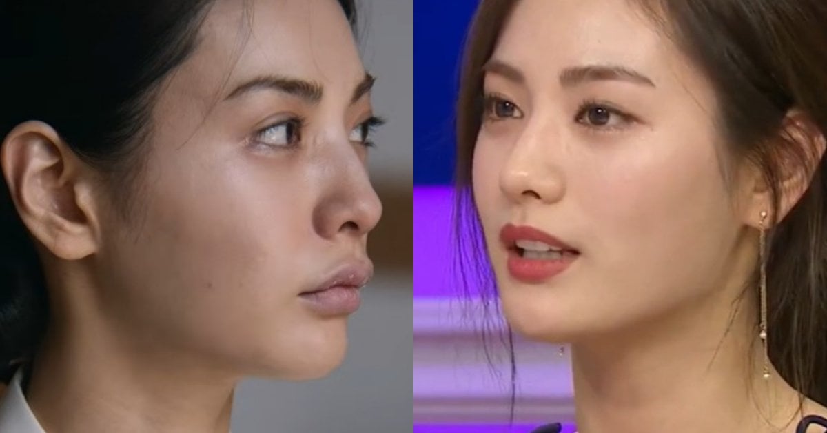 NANA 林珍兒《挑情醜聞》嘴唇變化掀熱議!遭疑唇部填充出戲,本人親自道歉了!