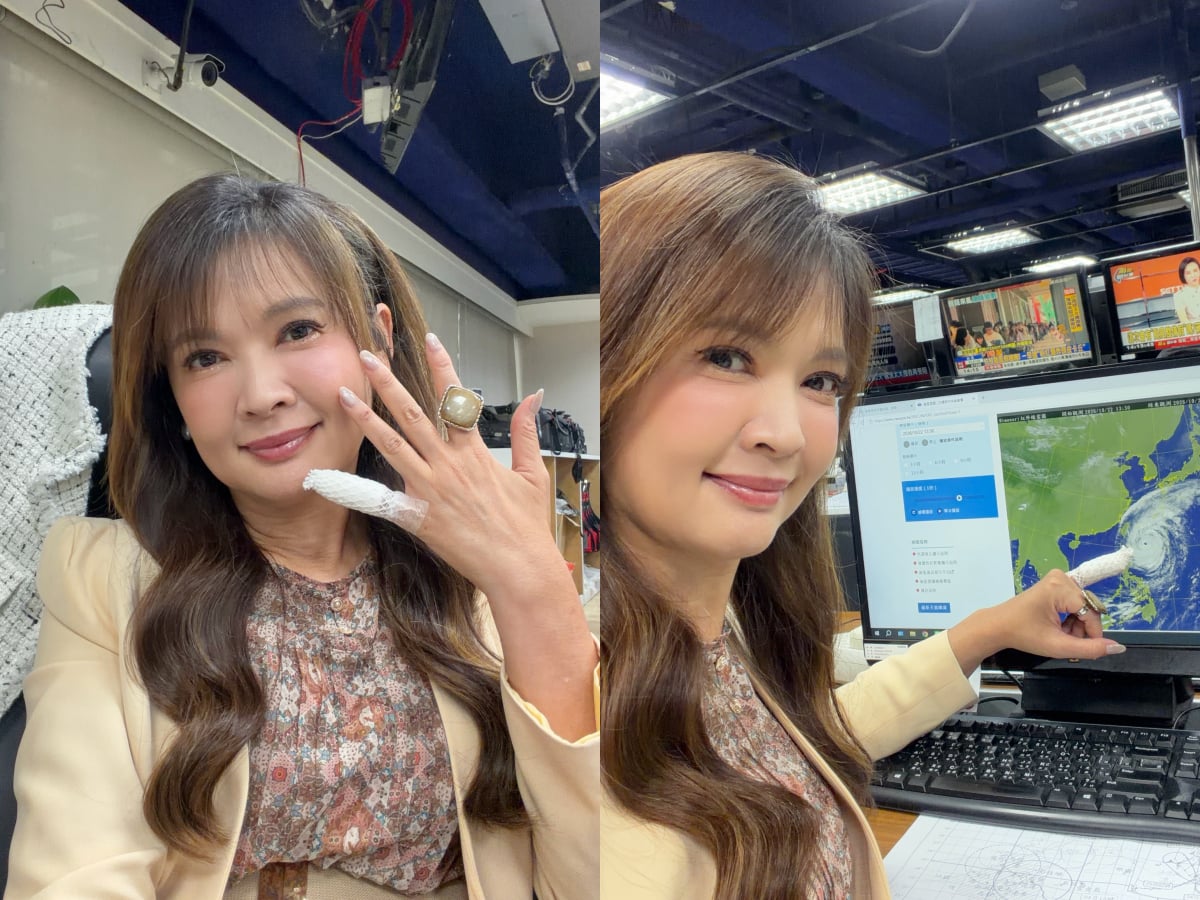 王淑麗播薔琵颱風小指包紗布超醒目！上週日屏東重摔，醫師一句話讓她笑出來！