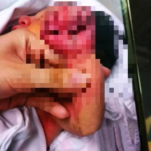 中國驚爆「吃人肉」案！      護士目擊母親啃咬嬰兒手臂