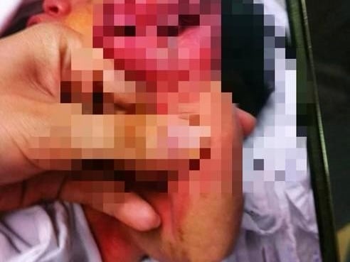 中國驚爆「吃人肉」案！      護士目擊母親啃咬嬰兒手臂