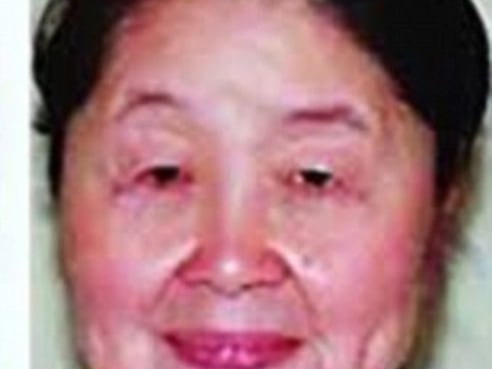 她真的只有 28 歲 一夜之間變成 80 歲老奶奶