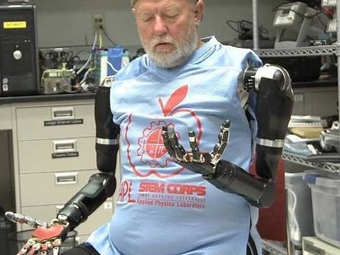 這名失去 40 年雙臂的男子  獲准取得全球第一對可以用「腦」控制的機器雙手