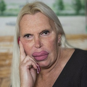 40 年來一直夢想變成女生的男子　展現了驚人的整形成果...