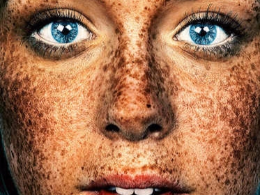 專拍雀斑的倫敦攝影師　讓雀斑 #Freckles 成為網路焦點！