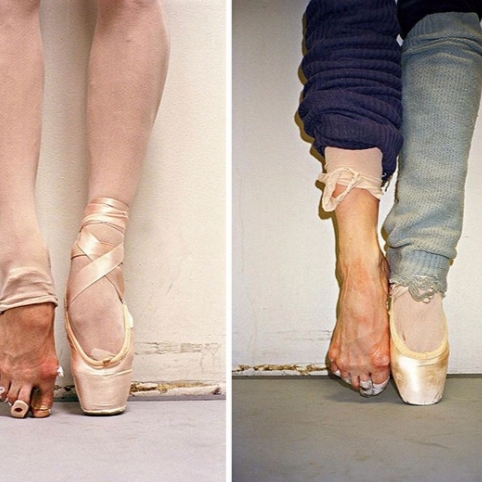細看芭蕾舞者的雙腳　體會追求完美所需要承受的痛苦！