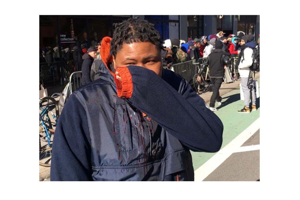 流血、衝突事件不斷！Supreme 倫敦專門店將被關閉？