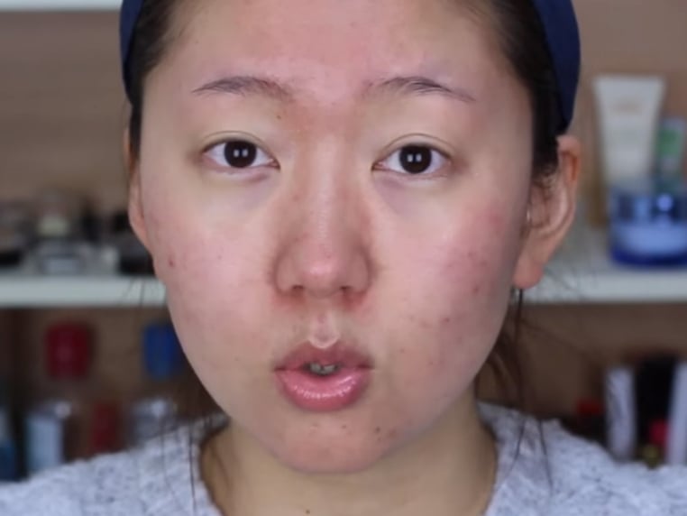 韓國驚人化妝術居然比整形還厲害！爛臉女孩變身嬰兒肌膚原來是靠...