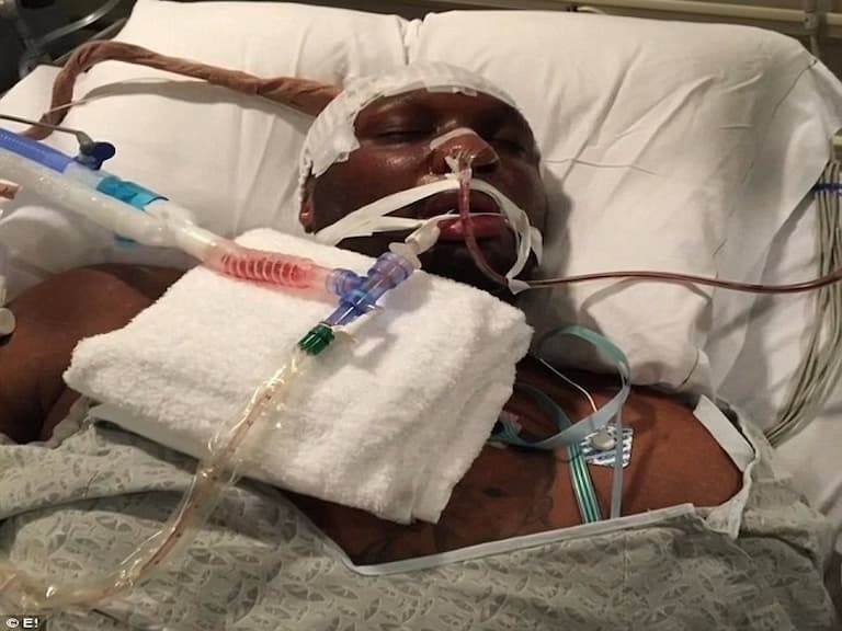 前 NBA 球星歐登去年妓院昏迷 送醫插管畫面首度被曝光!